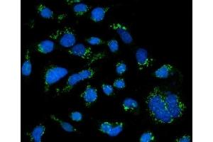 IF analysis of GRASP65/GORASP1 using anti-GRASP65/GORASP1 antibody (ABIN7599953). (GORASP1 anticorps  (AA 130-440))