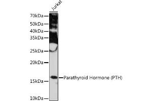 Western blot analysis of extracts of Jurkat cells, using Parathyroid Hormone (PTH) (PTH) Rabbit mAb (ABIN7269175) at 1:1000 dilution. (PTH anticorps)