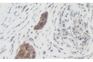 Immunohistochemistry (IHC) image for anti-Wingless-Type MMTV Integration Site Family, Member 1 (WNT1) antibody (ABIN2477142) (WNT1 anticorps)