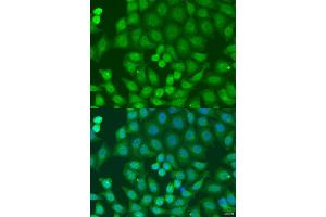 Immunofluorescence analysis of U2OS cells using ZFYVE16 antibody (ABIN2737838) at dilution of 1:100. (ZFYVE16 anticorps)