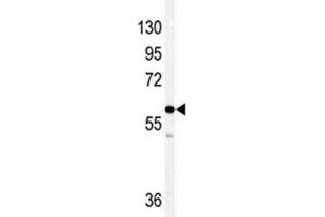 Western blot analysis of anti-Vimentin antibody and NCI-H460 lysate