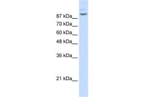 Western Blotting (WB) image for anti-Matrin 3 (MATR3) antibody (ABIN2462282)