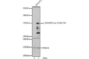 Western blot analysis of extracts of NIH/3T3 cells, using Phospho-PKC mu-S744/748 pAb (ABIN7269641) at 1:1000 dilution or PRKD1 antibody (ABIN7269644). (PKC mu anticorps  (pSer744, pSer748))