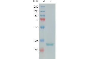 Human Protein, His Tag on SDS-PAGE under reducing condition.