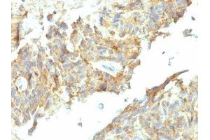 Image no. 2 for anti-Alkaline Phosphatase (ALP) antibody (ABIN6155884) (Alkaline Phosphatase anticorps)