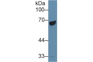 Detection of PCK1 in Human Liver lysate using Polyclonal Antibody to Phosphoenolpyruvate Carboxykinase 1, Soluble (PCK1) (PCK1 anticorps  (AA 311-558))