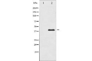 Western blot analysis of MKK3 expression in MDA-MB-435 whole cell lysates,The lane on the left is treated with the antigen-specific peptide. (MAP2K3 anticorps  (Internal Region))