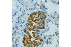 Immunohistochemistry of paraffin-embedded mouse lung using CYP2B6 antibody. (CYP2B6 anticorps)