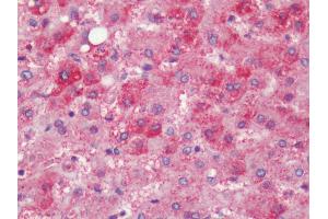 Human, Liver: Formalin-Fixed Paraffin-Embedded (FFPE)