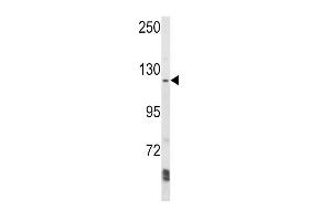 Western blot analysis of K1 Antibody (N-term) (ABIN652404 and ABIN2841978) in Ramos cell line lysates (35 μg/lane). (AAK1 anticorps  (N-Term))