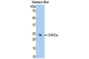 Western blot analysis of the recombinant protein. (Caspase 1 anticorps  (AA 119-296))