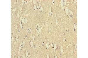 Immunohistochemistry of paraffin-embedded human brain tissue using ABIN7175313 at dilution of 1:100 (VPS33B anticorps  (AA 348-617))