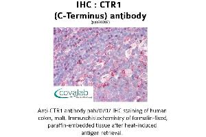Image no. 1 for anti-Solute Carrier Family 31 (Copper Transporters), Member 1 (SLC31A1) (C-Term) antibody (ABIN1733362)