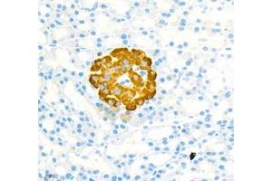 Immunohistochemistry of paraffin embedded rat pancreatic using MADCAM1 (ABIN7074695) at dilution of 1:1700 (400x lens) (MADCAM1 anticorps)