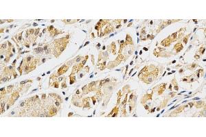 Immunohistochemistry of paraffin-embedded Human stomach using LGALS3 Polyclonal Antibody at dilution of 1:200 (40x lens).