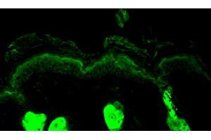 Calreticulin, Mouse backskin.