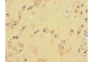Immunohistochemistry of paraffin-embedded human placenta tissue using ABIN7171961 at dilution of 1:100 (TGFBR2 anticorps  (AA 25-159))