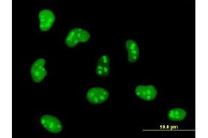 Immunofluorescence of monoclonal antibody to HMGB1 on HeLa cell. (HMGB1 anticorps  (AA 1-215))