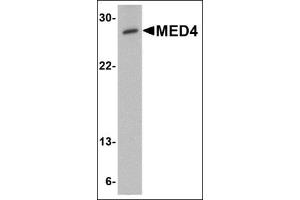 Western blot analysis of MED4 in human testis tissue lysate with this product at 0. (MED4 anticorps  (C-Term))