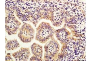 Formalin-fixed and paraffin embedded mouse embryo labeled with Rabbit Anti-MAP4 Polyclonal Antibody, Unconjugated (ABIN754243) at 1:200 followed by conjugation to the secondary antibody and DAB staining