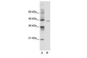 Image no. 1 for anti-DEAD (Asp-Glu-Ala-Asp) Box Polypeptide 25 (DDX25) (AA 355-404) antibody (ABIN6736105)