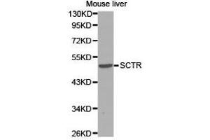 Western Blotting (WB) image for anti-Secretin Receptor (SCTR) antibody (ABIN1874706) (SCTR anticorps)