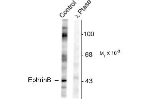 Western blots of rat testes lysate showing specific immunolabeling of the ~46k EphrinB phosphorylated at Tyr317 (Control). (EPH Receptor B2 anticorps  (pTyr317))