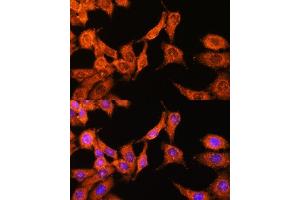 Immunofluorescence analysis of HeLa cells using N-WASP/WASL Polyclonal Antibody (ABIN3016273, ABIN3016274, ABIN3016275, ABIN1683282 and ABIN6219682) at dilution of 1:100 (40x lens). (Neural Wiskott-Aldrich syndrome protein (WASL) (AA 1-250) anticorps)