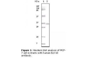 Image no. 2 for anti-B-Cell CLL/lymphoma 10 (BCL10) antibody (ABIN207592) (BCL10 anticorps)