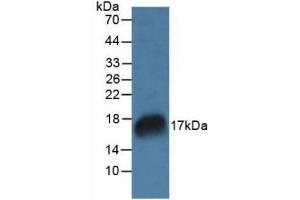 Detection of RNASE7 in Rat Marrow Tissue using Polyclonal Antibody to Ribonuclease A7 (RNASE7) (RNASE7 anticorps  (AA 31-155))