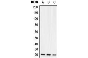 Western blot analysis of RGS10 expression in Jurkat (A), Raw264. (RGS10 anticorps  (Center))