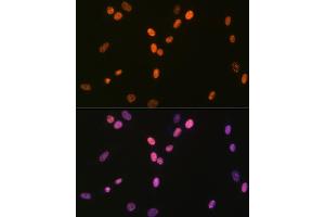 Immunofluorescence analysis of NIH-3T3 cells using DHX9/DHX9/RNA Helicase A Rabbit mAb (ABIN7265747) at dilution of 1:100 (40x lens).