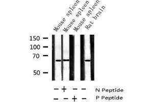 Western blot analysis of Phospho-NF kappaB p65 (Ser281) expression in various lysates (NF-kB p65 anticorps  (pSer281))