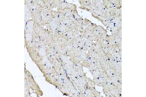 Immunohistochemistry of paraffin-embedded rat heart using USH1C antibody.