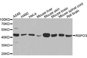 Western blot analysis of extracts of various cell lines, using RSPO3 antibody.