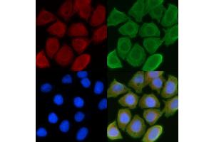 ABIN6257057 and ABIN6274550 staining Hela cells(45 min of heat-shock) by IF/ICC. (CHKB anticorps  (C-Term))