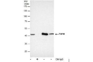 IP Image Immunoprecipitation of TUFM protein from HepG2 whole cell extracts using 5 μg of TUFM antibody , or TUFM antibody, Western blot analysis was performed using TUFM antibody, EasyBlot anti-Rabbit IgG  was used as a secondary reagent. (TUFM anticorps)