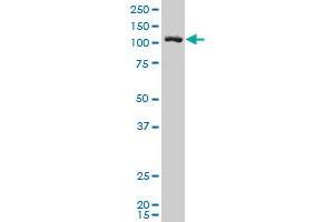 DDEF2 polyclonal antibody (A01), Lot # 060501JCS1 Western Blot analysis of DDEF2 expression in SJCRH30 .