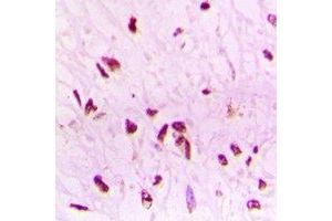Immunohistochemical analysis of BAF53B staining in human brain formalin fixed paraffin embedded tissue section.