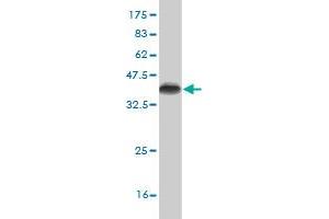 Western Blot detection against Immunogen (35. (CDK4 anticorps  (AA 211-303))