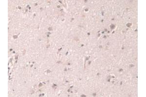 Figure. (Grancalcin anticorps  (AA 1-139))