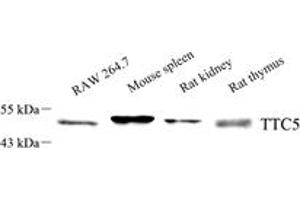 Western blot analysis of TTC5 (ABIN7075874),at dilution of 1: 1000,Lane 1: RAW 264. (TTC5 anticorps)