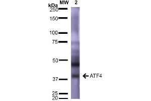 Western Blot analysis of Rat Brain showing detection of ~39 kDa (isoform 2) ATF4 protein using Mouse Anti-ATF4 Monoclonal Antibody, Clone S360A-24 .