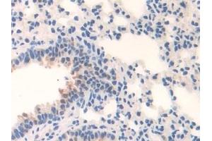 Detection of MAOB in Mouse Lung Tissue using Polyclonal Antibody to Monoamine Oxidase B (MAOB)