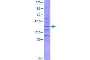 Image no. 1 for Chromosome 4 Open Reading Frame 6 (C4orf6) (AA 1-93) protein (GST tag) (ABIN1347561)