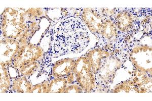 Detection of gp130 in Human Kidney Tissue using Polyclonal Antibody to Glycoprotein 130 (gp130)