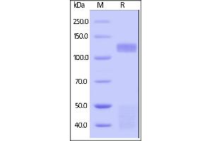 Human Insulin R (28-944), His Tag (SPR verified) on  under reducing (R) condition.