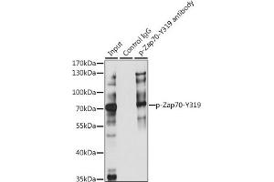 Immunoprecipitation analysis of 200 μg extracts of Jurkat cells, using 3 μg Phospho-Z-Y319 pAb (ABIN3023645, ABIN3023646, ABIN3023647, ABIN1682143 and ABIN1682144). (ZAP70 anticorps  (pTyr319))
