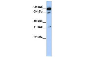 WB Suggested Anti-ABCD4 Antibody Titration:  0. (ABCD4 anticorps  (N-Term))