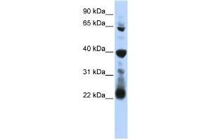 WB Suggested Anti-RPUSD3 Antibody Titration:  0. (RPUSD3 anticorps  (Middle Region))